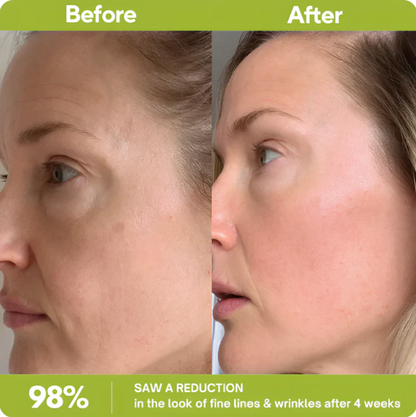 Korean Retinal Tightening Booster